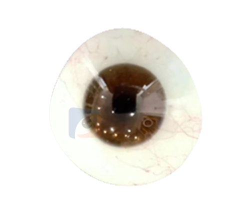 三明进口义眼定制